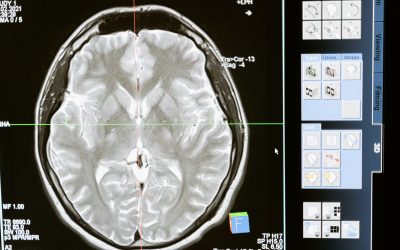 Que Soigne un Neuropsychiatre ?