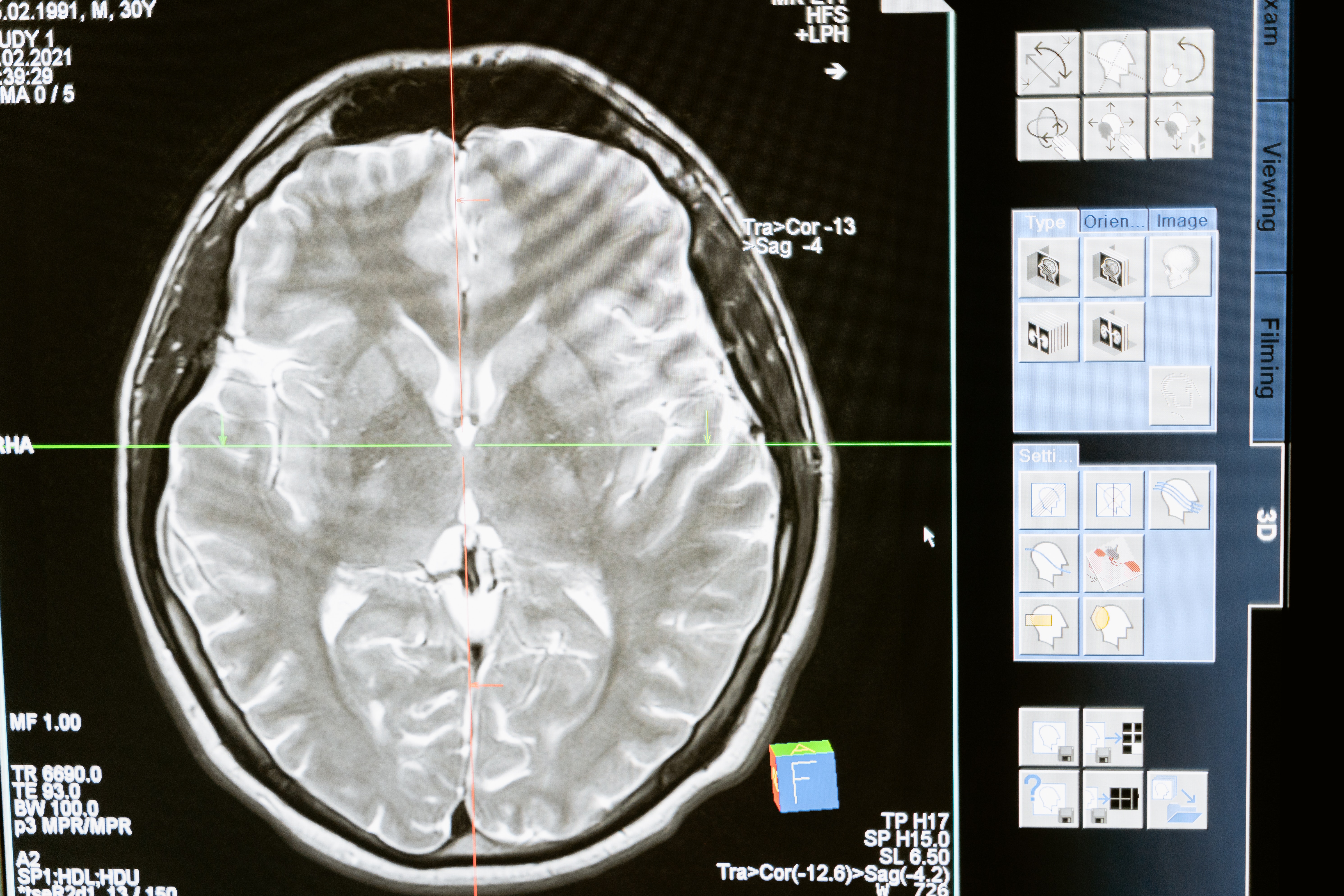 que-soigne-neuropsychiatre