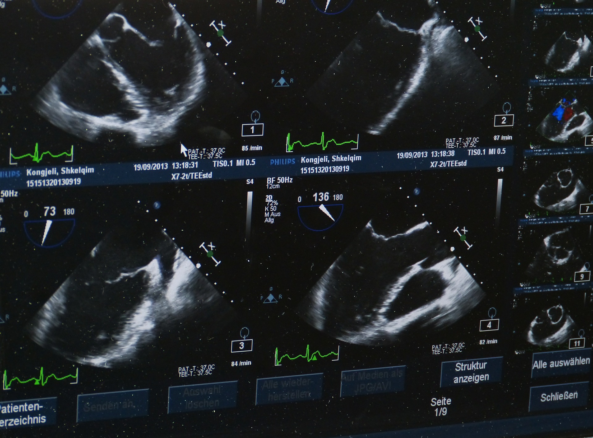 quand-faire-premiere-echographie